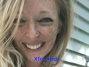 Xfreckledx